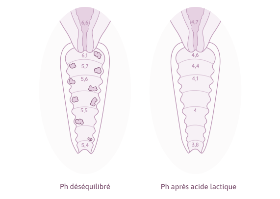En savoir plus sur les déséquilibres PH et Premeno Duo de Medintim