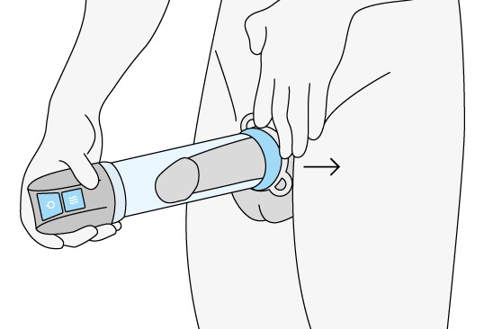 Anneaux de constriction Medintim pour le maintien de l'érection