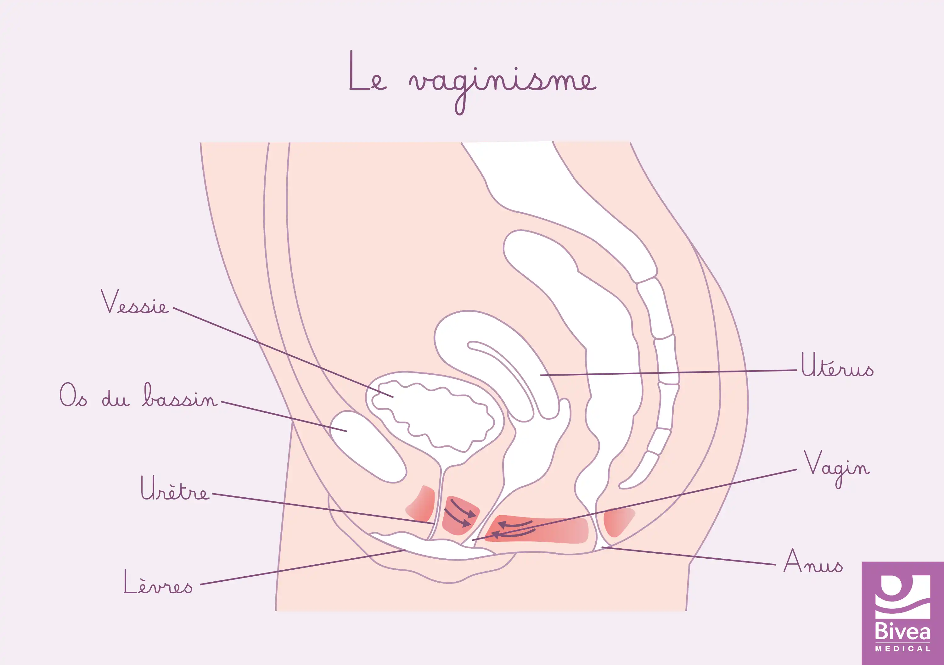 Carte anatomique vaginisme