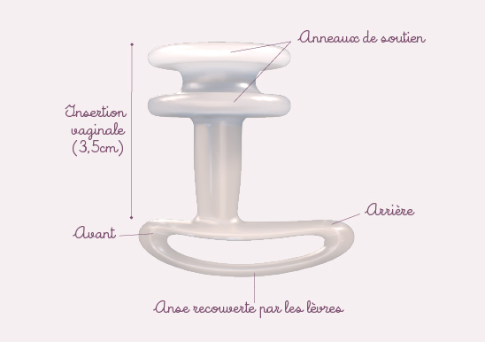 Caractéristiques du pessaire pour incontinence urinaire Efemia 