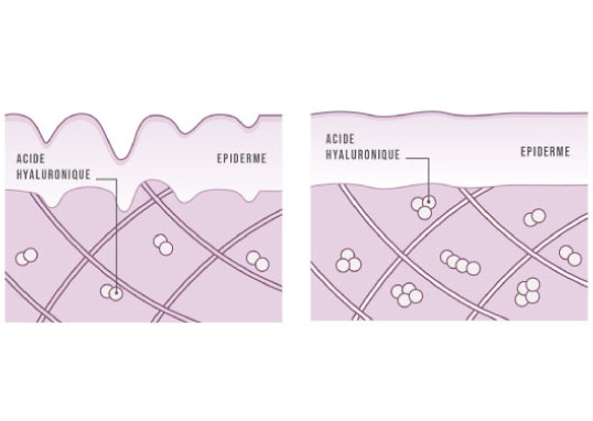 Action acie-hyaluronique